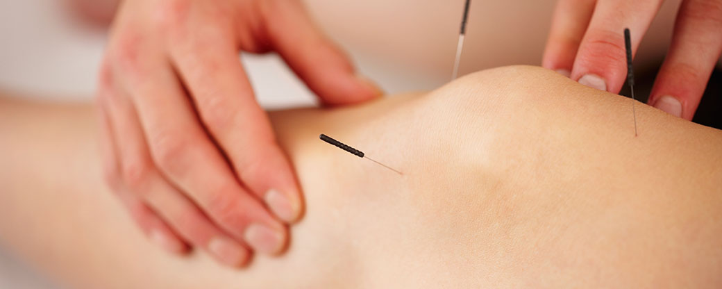 Acupuncture therapy